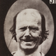 Image for article titled Terrifying, Century-Old Photographs from Neuroscience Experiments